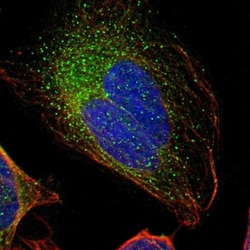 GAL3ST1 Antibody, Novus Biologicals 25 &mu;L; Unlabeled:Antibodies, Polyclonal